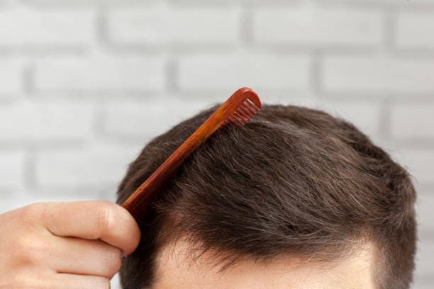 Hair Transplant Turkey Cost: Why Istanbul Is the Global Hub
